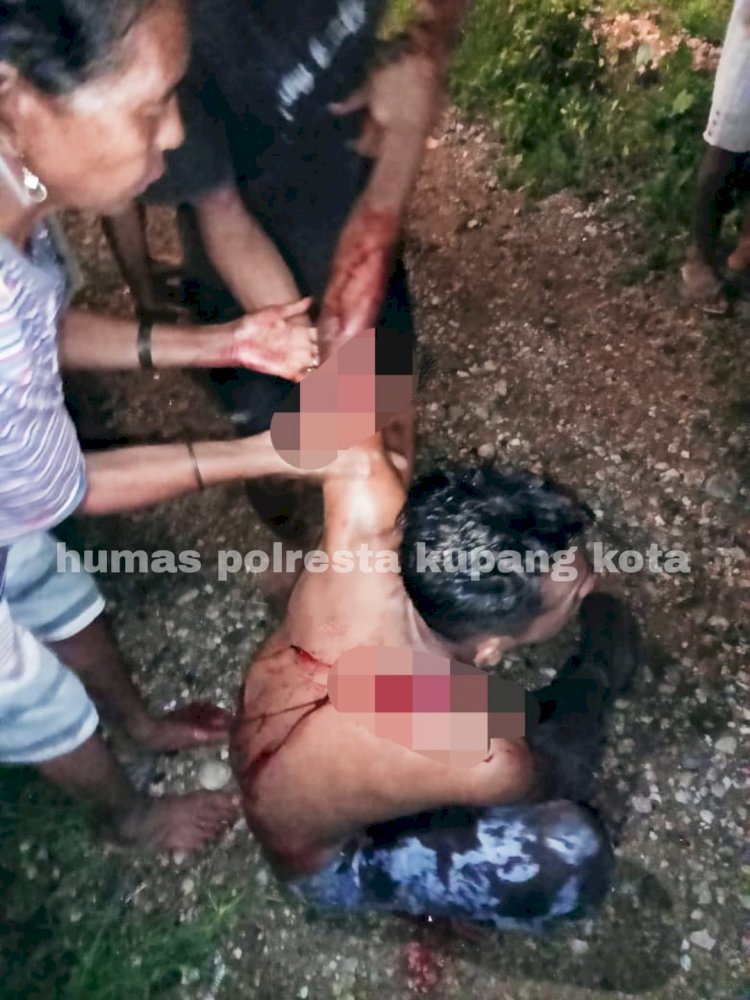 Diserang Dengan Benda Tajam (Parang), Stefanus dan Yulius Mengalami Luka Robek